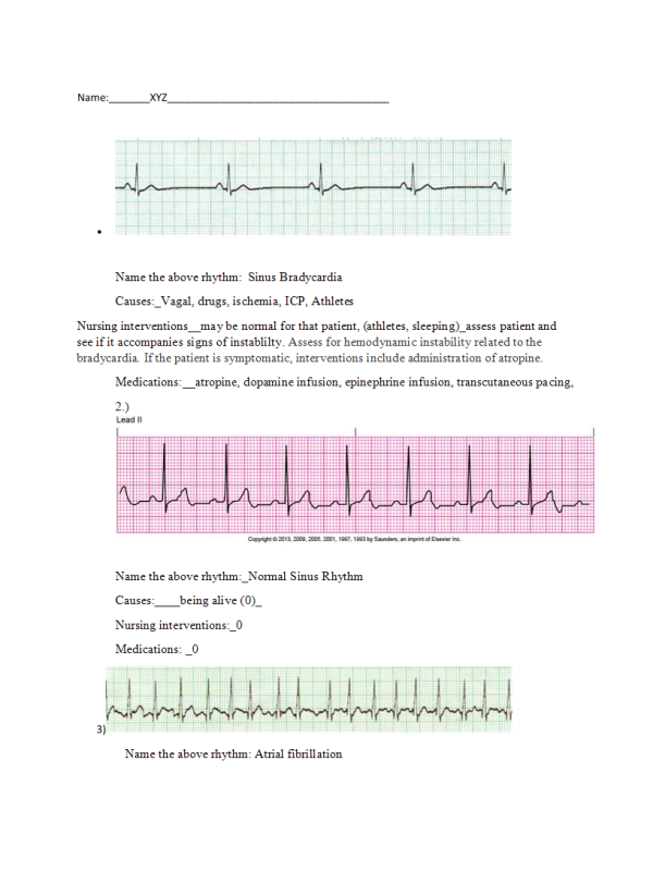 EKG Interpretation Packet - Rhythm & Causes